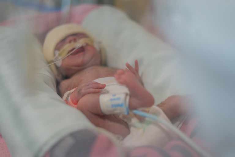 Bebé prematura sobrevive en la UMAE 48 del IMSS en León; su madre fue donadora de órganos